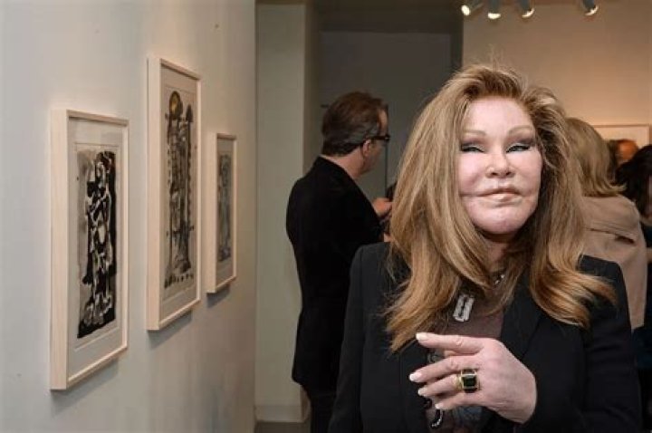 Plastic Surgery Queen Jocelyn Wildenstein Files For Bankruptcy